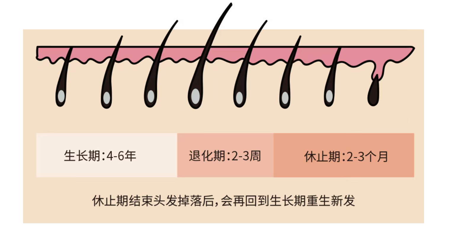 植发还是用米诺地尔？看完这篇再做决定
