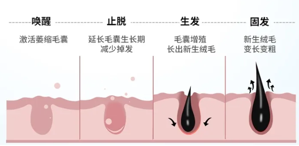 达霏欣米诺地尔搽剂：科学分治，破解脱发难题的“生发密码”
